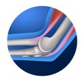 Anatomy of the elbow joint.
